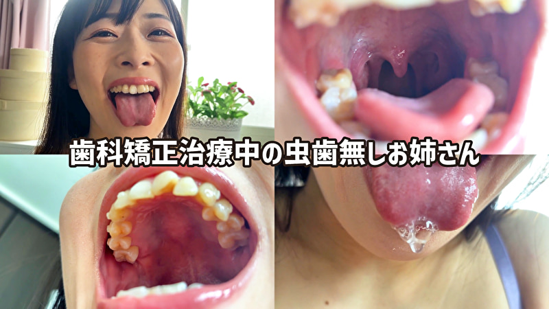 街角で声をかけて口内観察させてもらう ファーストフード店パート みおりさん